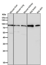 Anti-GR NR3C1 Rabbit Monoclonal Antibody Boster Bio
