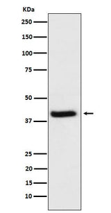 Anti-HFE Rabbit Monoclonal Antibody Boster Bio