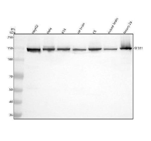 Anti-SF3B1 Rabbit Monoclonal Antibody Boster Bio