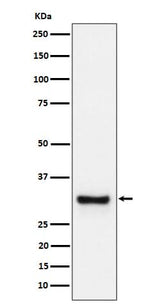 Anti-Adiponectin Rabbit Monoclonal Antibody Boster Bio