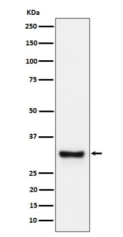 Anti-Adiponectin Rabbit Monoclonal Antibody Boster Bio