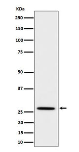 Anti-Adiponectin Rabbit Monoclonal Antibody Boster Bio