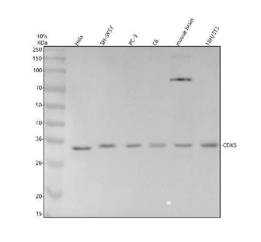 Anti-CDK5 Rabbit Monoclonal Antibody Boster Bio