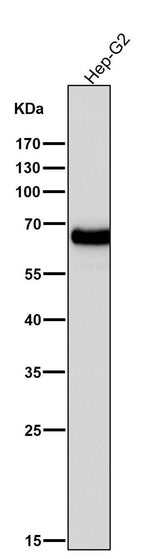 Anti-AFP/Alpha 1 Fetoprotein Rabbit Monoclonal Antibody Boster Bio
