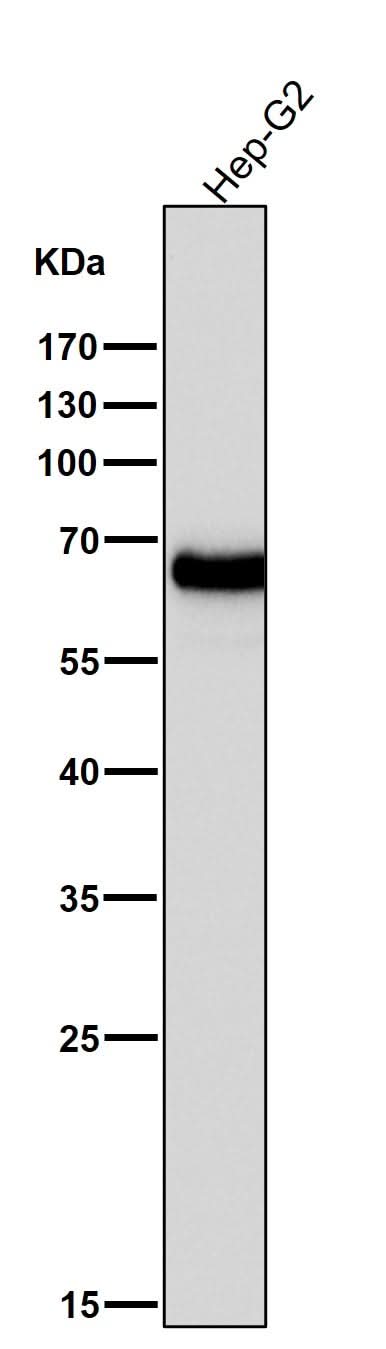 Anti-AFP/Alpha 1 Fetoprotein Rabbit Monoclonal Antibody Boster Bio