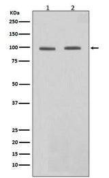 Anti-STAT6 Rabbit Monoclonal Antibody Boster Bio
