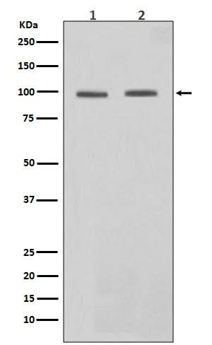 Anti-STAT6 Rabbit Monoclonal Antibody Boster Bio