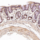 Anti-STAT6 Rabbit Monoclonal Antibody Boster Bio