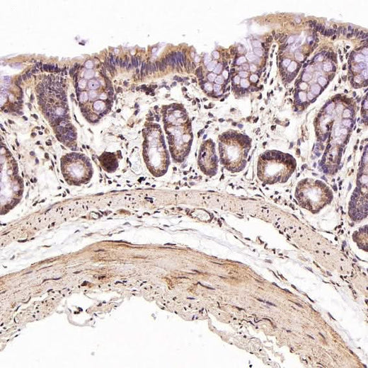 Anti-STAT6 Rabbit Monoclonal Antibody Boster Bio