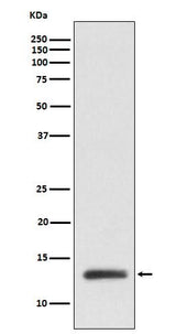 Anti-ROC1 Monoclonal Antibody Boster Bio