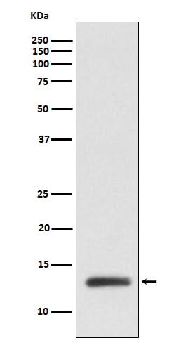 Anti-ROC1 Monoclonal Antibody Boster Bio