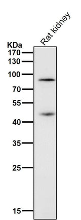 Anti-Gli1 Rabbit Monoclonal Antibody Boster Bio