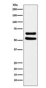 Anti-Ikaros Monoclonal Antibody Boster Bio