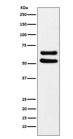 Anti-Ikaros Monoclonal Antibody Boster Bio