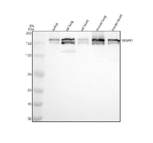 Anti-VEGF Receptor 1 FLT1 Rabbit Monoclonal Antibody Boster Bio