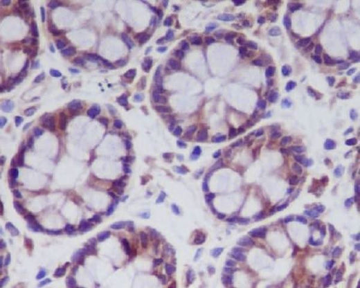 Anti-MLKL Rabbit Monoclonal Antibody Boster Bio