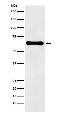 Anti-Factor IX Rabbit Monoclonal Antibody Boster Bio