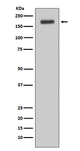 Anti-ErbB (HER3) Rabbit Monoclonal Antibody Boster Bio