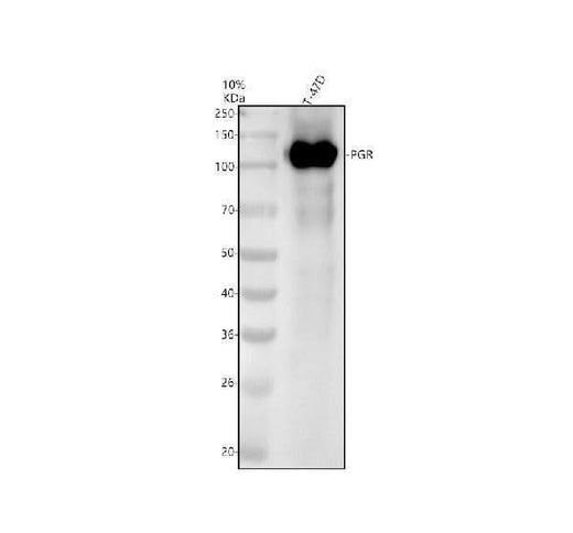 Anti-Progesterone Receptor PGR Rabbit Monoclonal Antibody Boster Bio