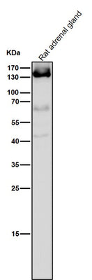 Anti-Androgen Receptor AR Rabbit Monoclonal Antibody Boster Bio