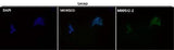 Anti-Androgen Receptor AR Rabbit Monoclonal Antibody Boster Bio