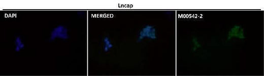 Anti-Androgen Receptor AR Rabbit Monoclonal Antibody Boster Bio