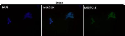 Anti-Androgen Receptor AR Rabbit Monoclonal Antibody Boster Bio