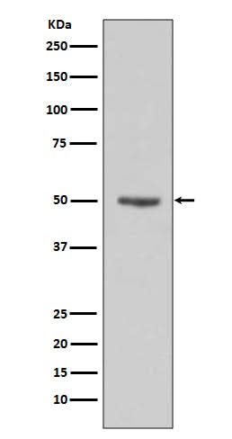 Anti-Cyclin E1 CCNE1 Rabbit Monoclonal Antibody Boster Bio
