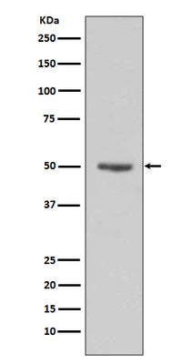 Anti-Cyclin E1 CCNE1 Rabbit Monoclonal Antibody Boster Bio