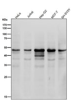 Anti-Cyclin E1 CCNE1 Rabbit Monoclonal Antibody Boster Bio