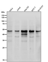 Anti-Cyclin E1 CCNE1 Rabbit Monoclonal Antibody Boster Bio
