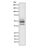 Anti-SKP2 Rabbit Monoclonal Antibody Boster Bio