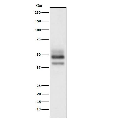 Anti-SKP2 Rabbit Monoclonal Antibody Boster Bio