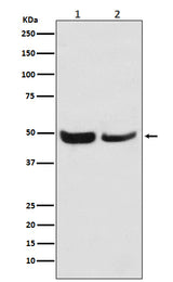 Anti-SKP2 Monoclonal Antibody Boster Bio