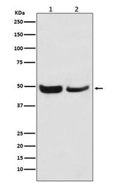 Anti-SKP2 Monoclonal Antibody Boster Bio