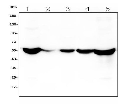Anti-ALDH2 Antibody Picoband® (monoclonal, 5G7 Boster Bio