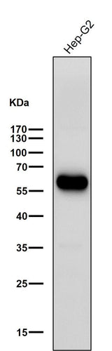 Anti-ALDH2 Rabbit Monoclonal Antibody Boster Bio