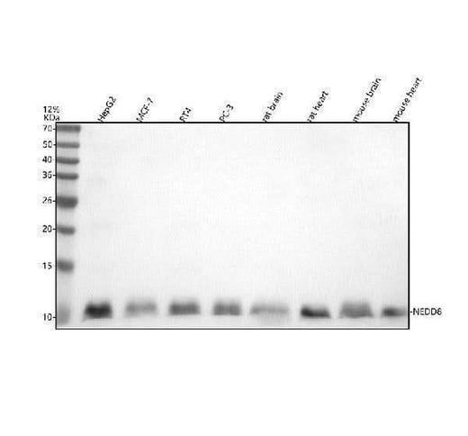 Anti-NEDD8 Rabbit Monoclonal Antibody Boster Bio
