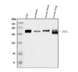 Anti-AREB6/ZEB1 Antibody Picoband® (monoclonal, 8B12D7 Boster Bio