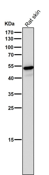 Anti-Wnt5a Rabbit Monoclonal Antibody Boster Bio