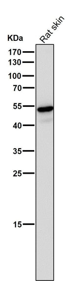 Anti-Wnt5a Rabbit Monoclonal Antibody Boster Bio