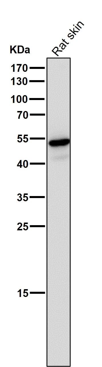 Anti-Wnt5a Rabbit Monoclonal Antibody Boster Bio