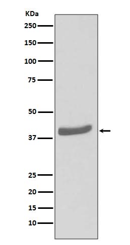 Anti-CDK7 Rabbit Monoclonal Antibody Boster Bio