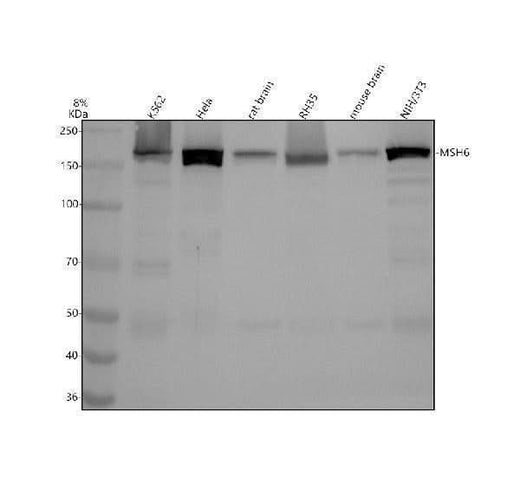 Anti-MSH6/Gtbp Rabbit Monoclonal Antibody Boster Bio