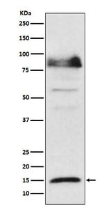 Anti-ISG15 Monoclonal Antibody Boster Bio