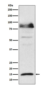 Anti-ISG15 Monoclonal Antibody Boster Bio