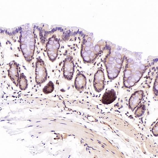 Anti-CD45 PTPRC Rabbit Monoclonal Antibody Boster Bio