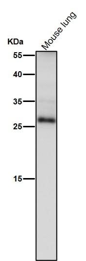Anti-TIMP1 Rabbit Monoclonal Antibody Boster Bio