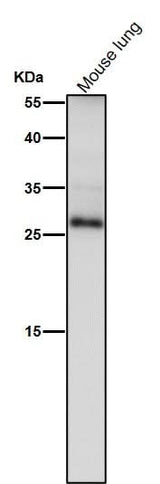 Anti-TIMP1 Rabbit Monoclonal Antibody Boster Bio