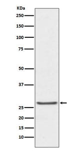 Anti-TIMP1 Rabbit Monoclonal Antibody Boster Bio